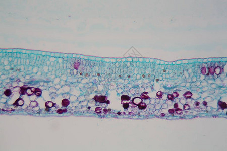 显微镜下表皮和叶绿体受损的植物叶片细胞损害是图片