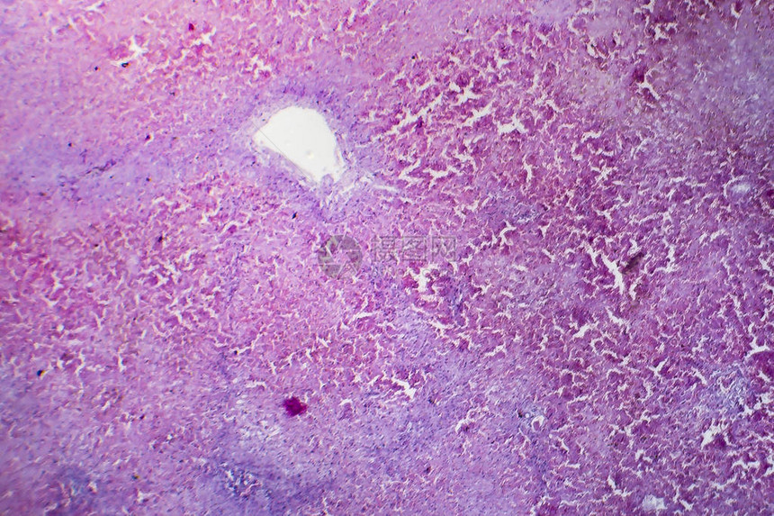 肝充血光学显微照片显微镜下的照片图片