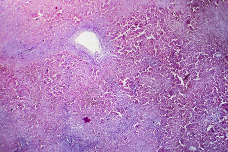 肝充血光学显微照片显微镜下的照片图片