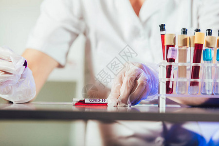 实验室技术员助理在实验室的试管中分析血样医疗制药和图片