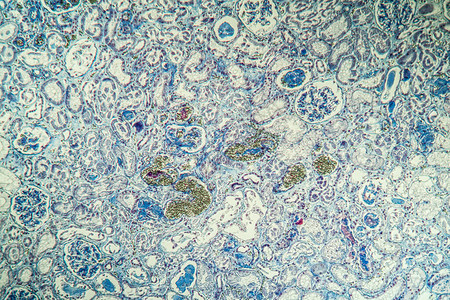 肾脏中的纤维素沉积显微镜检高清图片