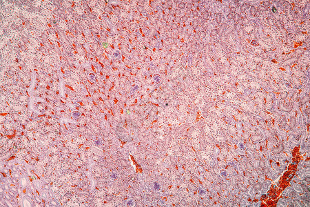 显微镜下的肾组背景图片