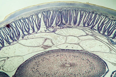 马蛔虫横断面与鸡蛋100倍图片