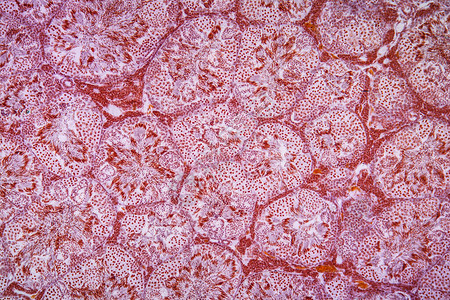 腺与精子GewebeunterdemMikrosko图片