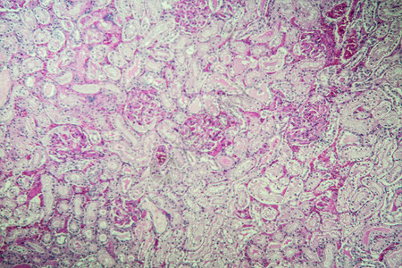 显微镜下的肾脏皮背景图片