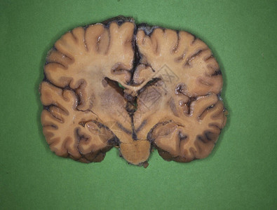 用神经切片的人脑图片