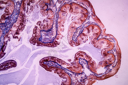 显微镜下的胃组背景图片