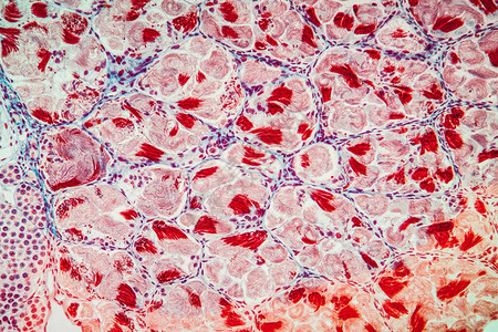 腺与精子GewebeunterdemMikrosko背景图片