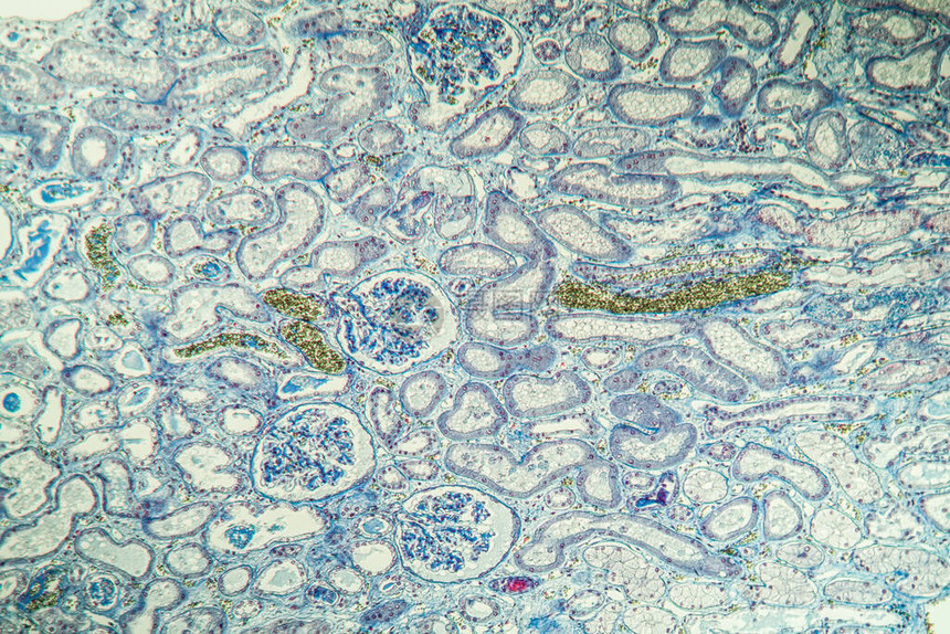 肾脏中的纤维素沉积显微镜检图片