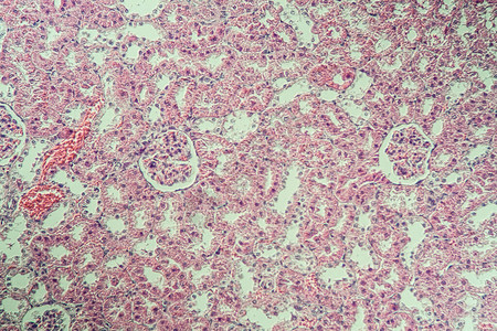 显微镜下的肾脏皮背景图片