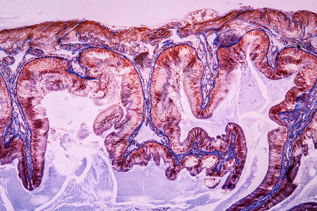 显微镜下的胃组图片