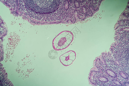肠道中的氧化物虫显微镜检图片