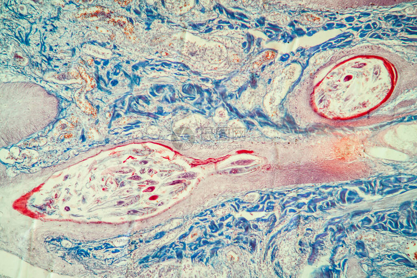 显微镜下的毛发泡皮肤组图片