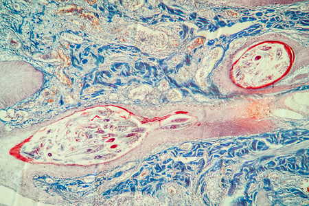 显微镜下的毛发泡皮肤组背景图片
