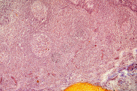 100倍显微镜下的杏仁扁桃体横截面背景图片