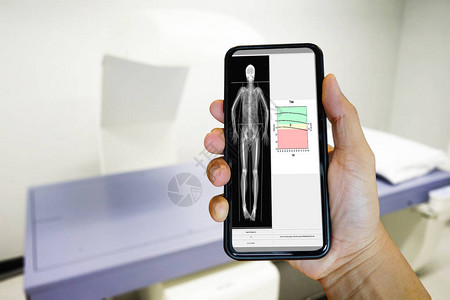 医生用智能手机背景模糊的BMDScAN医疗和健康技术概念图片