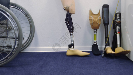 截肢患者的现代假腿图片