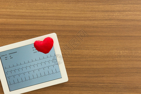 心电图心电图心脏显示在医生办公桌上的平板电脑上心脏病学和心脏检查的图片