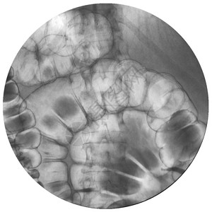X射线Bonibor肠胃内脏检查图片
