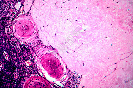 卵巢滤泡囊肿光学显微照片显微镜下照片背景图片