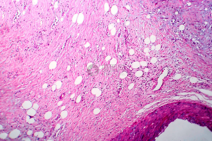 乳癌轻显微镜显图片