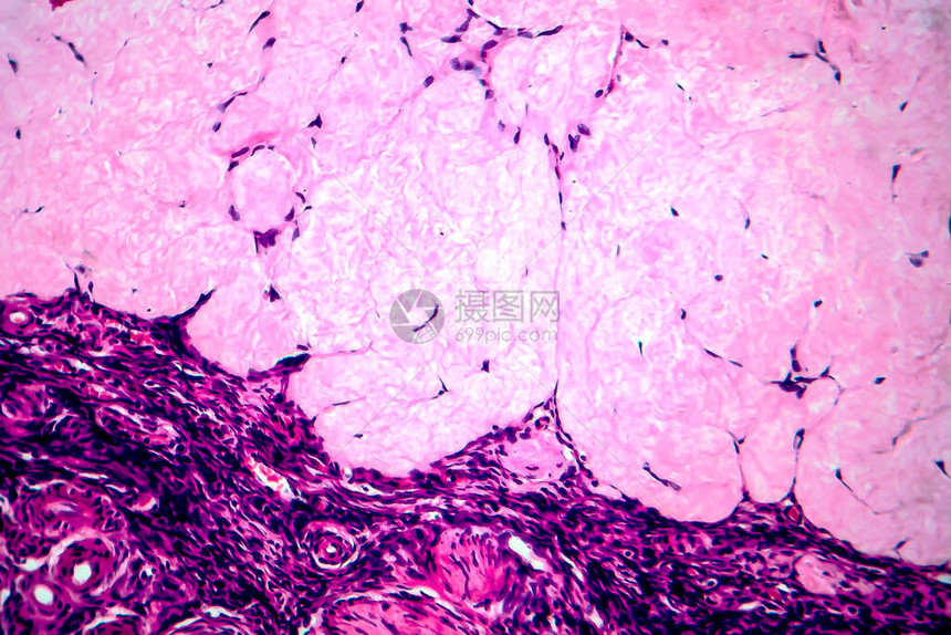 卵巢滤泡囊肿光学显微照片显微镜下照片图片
