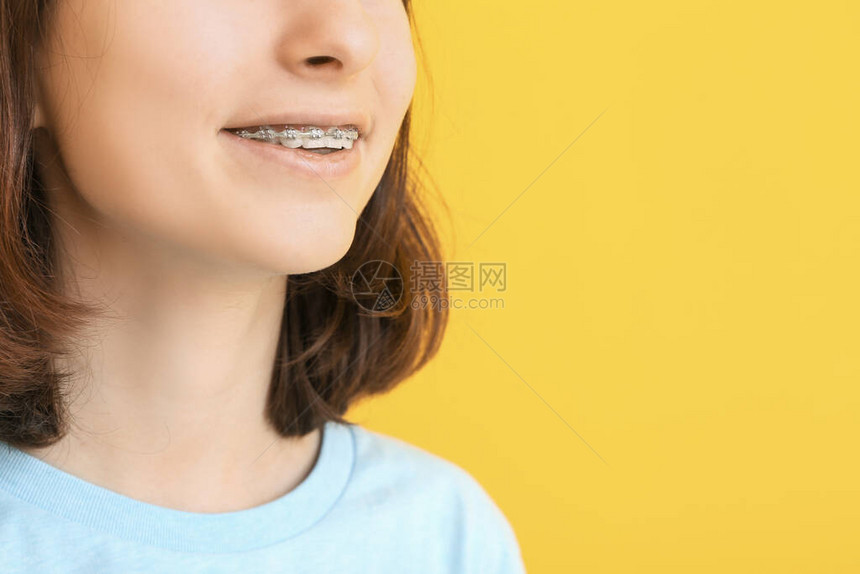 有牙套的青少年女孩颜图片
