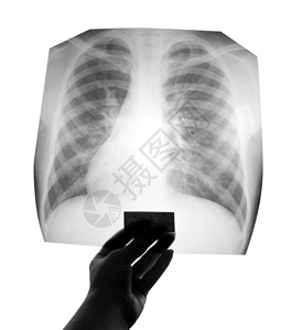 胸部X射线图像在手中图片