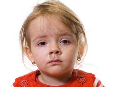 患有严重流感和红眼睛的小女孩图片
