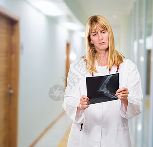 医生在室内走廊看X光片图片