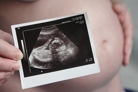 有超声波的孕妇图片