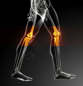 人体膝关节扫描图片