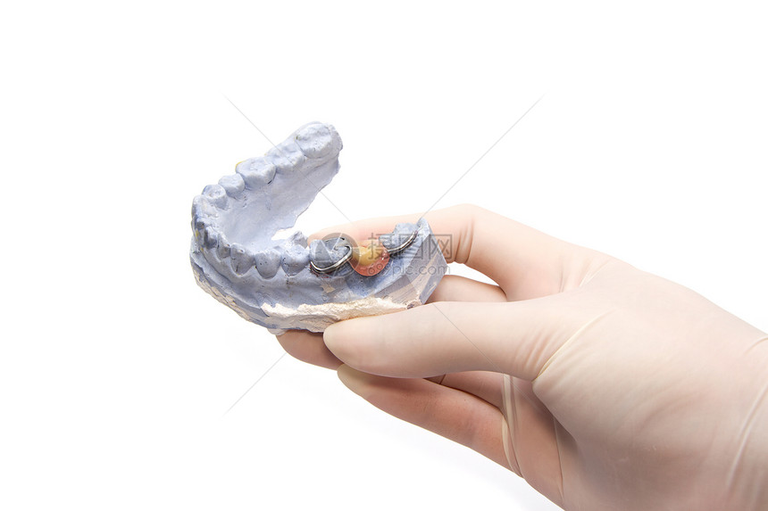 石膏模型石膏上的牙科假牙加上图片