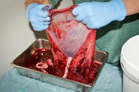 人胎盘被拉开以显示内部麻袋背景图片
