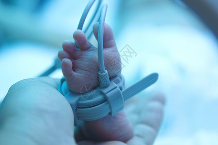保育箱紫外线灯下的早产儿脚背景图片