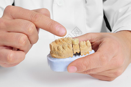一位牙医在牙科模具中展示假肢图片