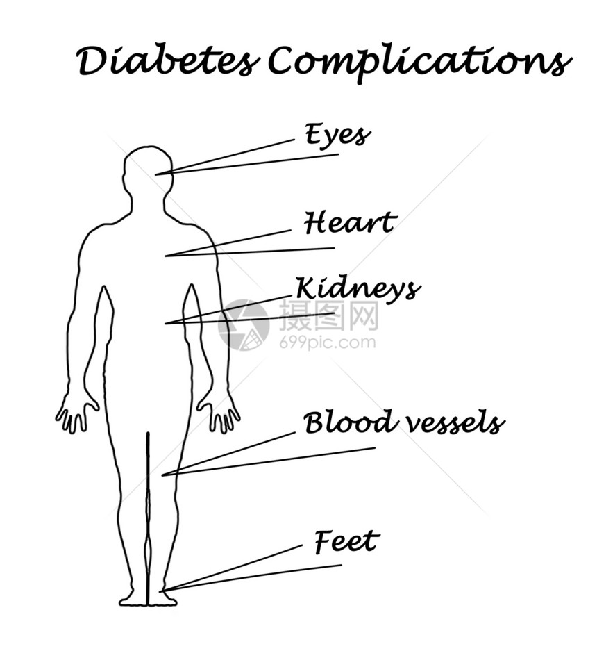 糖尿病并发症图片