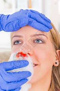 护士帮助流鼻血的年轻女子图片