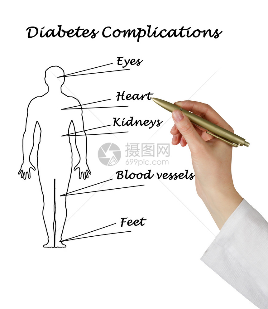 计划糖尿病并发症图片