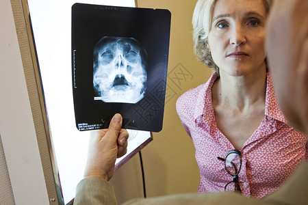 耳鼻喉老人鼻窦X光片图片