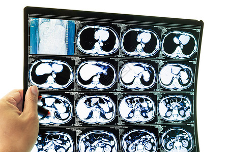 医学诊断背景CT扫描和手图片