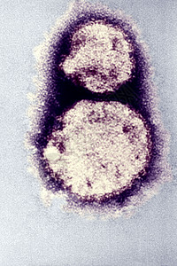 Hanta是Hanta肺综合症HPS高清图片