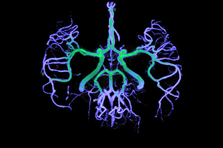 血管造影X射线研究图片