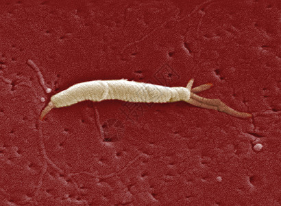 幽门杆菌显微镜下的Flexispira细菌背景