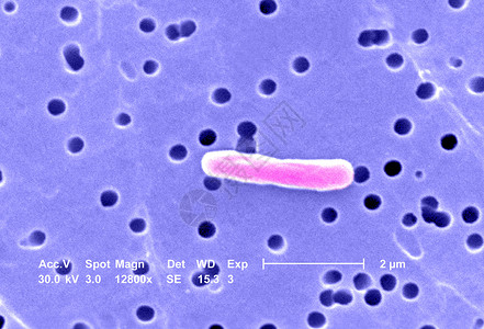 显微镜下的图像感染图片
