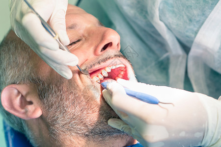 男患者在牙医办公室口腔卫生期间遭受痛苦图片