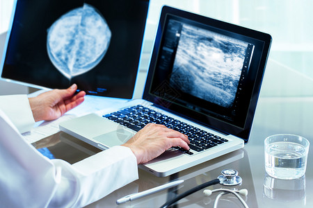 近距离检查X光乳房X光造影结果和笔记本电脑打图片