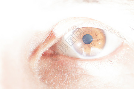 眼科检查中的老年白内障特写图片