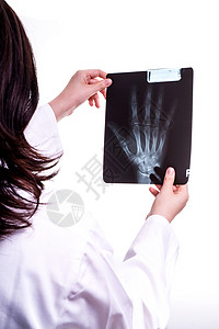 医生检查手的X射线手拿着射线照片背景图片