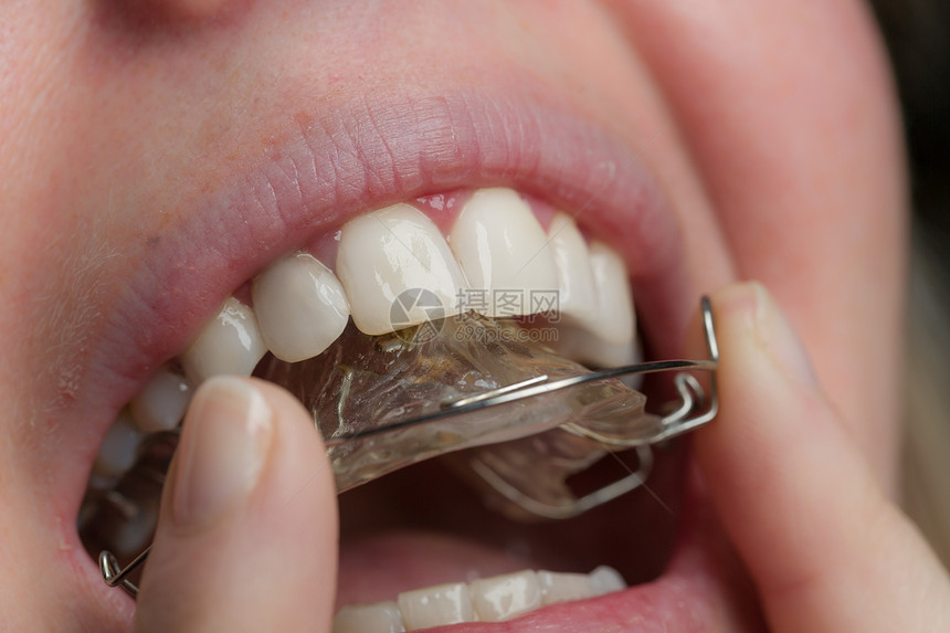 一个女孩正在调整她嘴里的牙套图片